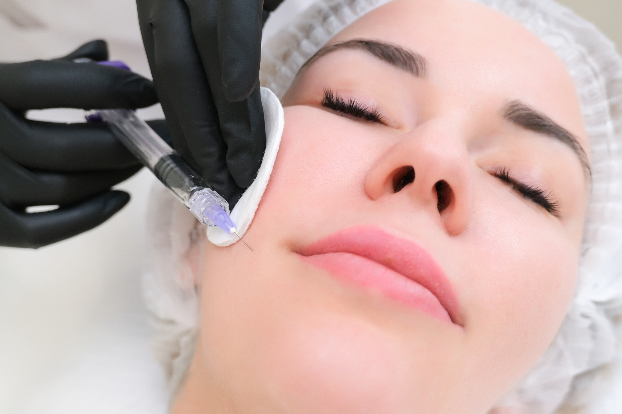 Botox sem vedno povezovala z neizraznimi obrazi